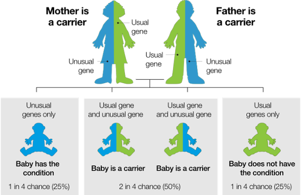 Infographic showing recessive inheritance: both parents are carriers (one usual gene, one unusual gene). Each child has a 25% chance of having the condition (two unusual genes), 50% chance of being a carrier (one usual, one unusual), and 25% chance of having two usual genes and not having the condition.